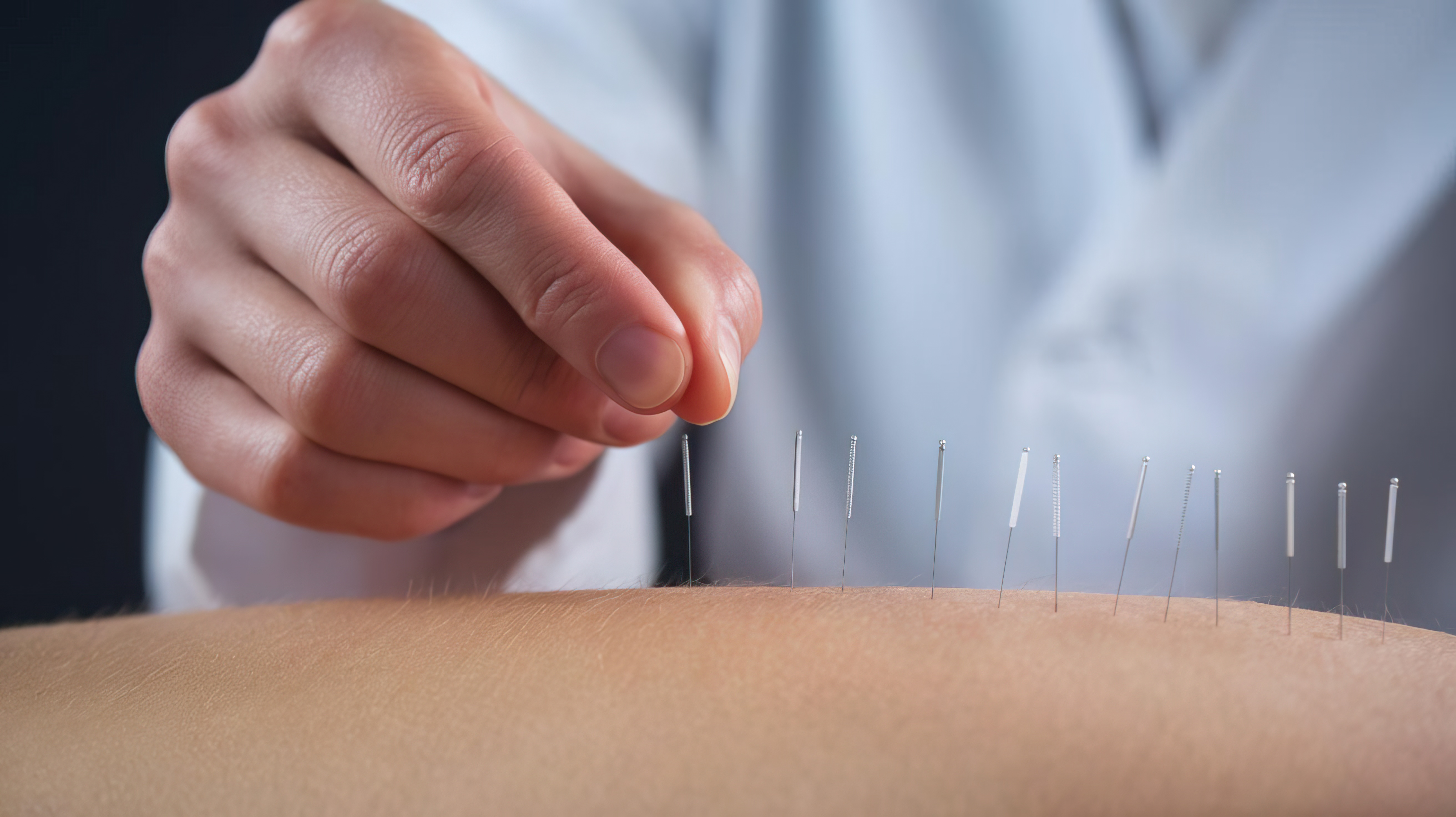 Dry needling and manual therapy